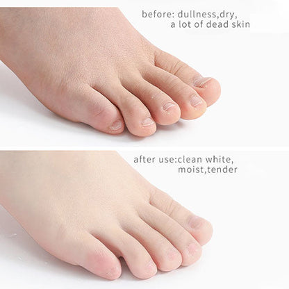 Foot Peeling Spray with Orange Oil Essence for Dead Skin Exfoliation
